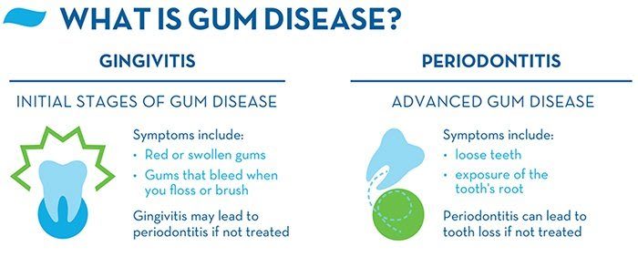 What is Gum Disease?